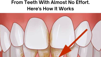 My Nanas Trick Removes Tartar Stains From Teeth With Almost No Effort Heres How It Works e1727075767180