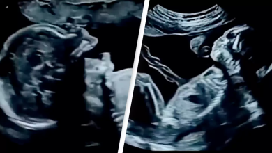 Amazing Footage Of What Babies Actually Do In The Womb Is Leaving People Stunned